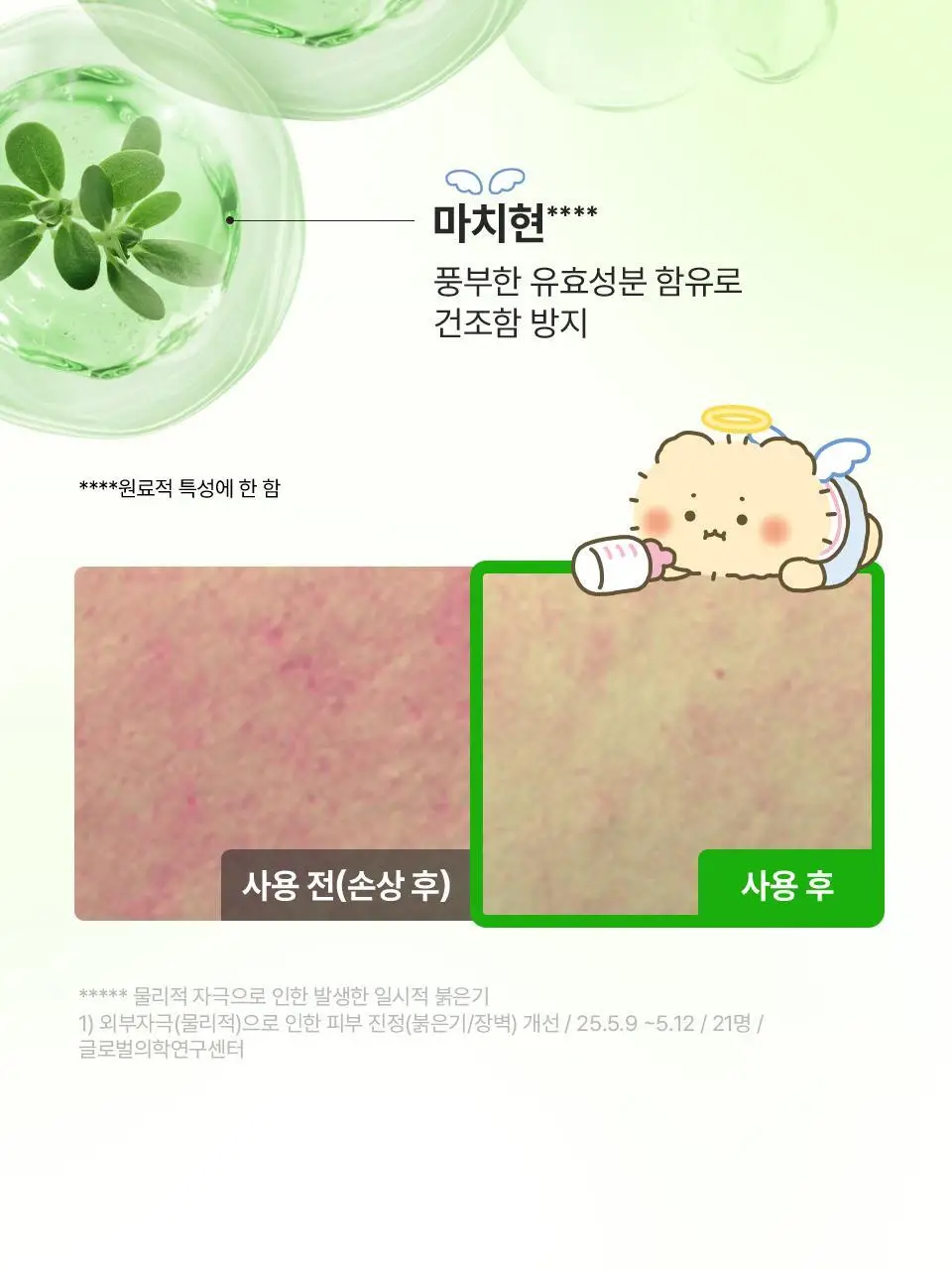 [망곰 콜라보] 아이소이 모이스춰 닥터 장수진 수분크림 100ml 대용량 기획 (+10ml+맥세이프 카드지갑) 상세페이지 22